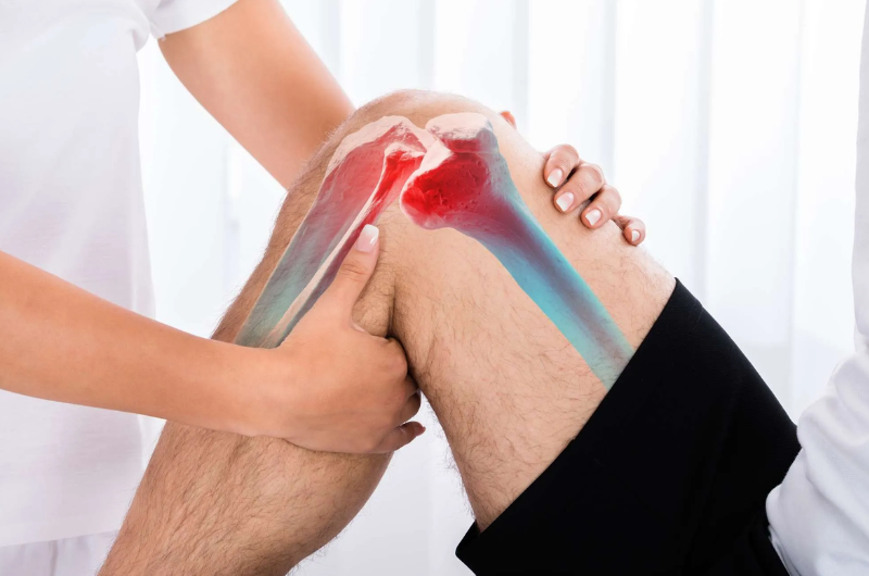 Complete or a partial ACL tear | HBG