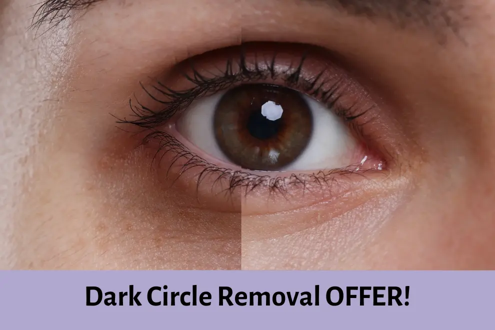 Dark Circle Removal - HBGMC